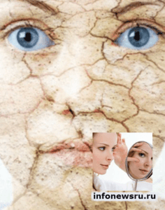 Старение кожи лица: причины которые его вызывают