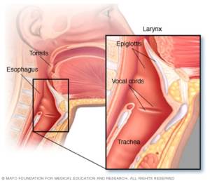 Рак горла-симптомы-лечение-причины-диагностика